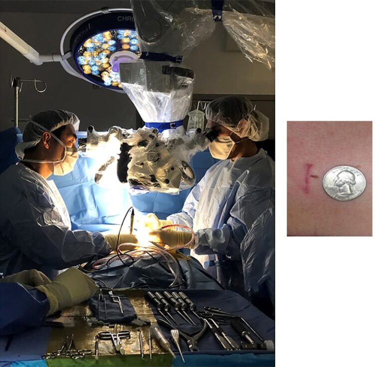 Lumbar Microdiscectomy Manhattan NYC Long Island